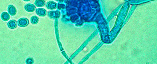 higiene ambiental hongos
