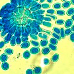 higiene ambiental microscopio hongos